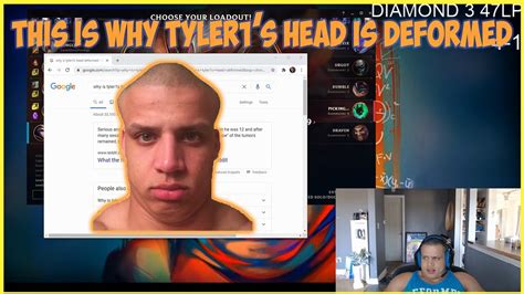 tyler1 head|what happened to tyler1 head.